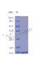 Recombinant Human Syndecan-4 (SDC4), partial (Active) | CSB-AP000331HU
