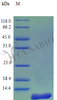 Recombinant Rhesus Macaque Amyloid protein A protein (SAA1) (Active) | CSB-AP001051MOW
