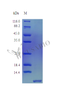 Recombinant Human Beta-defensin 1 protein (DEFB1), partial (Active) | CSB-AP003031HU
