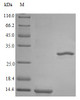 Recombinant Rhesus Macaque Interleukin-5 protein (IL5) (Active) | CSB-AP003091MOW
