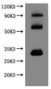 Recombinant Human Claudin-18.2 (CLDN18.2) -VLPs (Active)