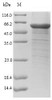 (Tris-Glycine gel) Discontinuous SDS-PAGE (reduced) with 5% enrichment gel and 15% separation gel. (Tris-Glycine gel) Discontinuous SDS-PAGE (reduced) with 5% enrichment gel and 15% separation gel.