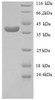 (Tris-Glycine gel) Discontinuous SDS-PAGE (reduced) with 5% enrichment gel and 15% separation gel.