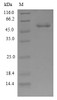 (Tris-Glycine gel) Discontinuous SDS-PAGE (reduced) with 5% enrichment gel and 15% separation gel.