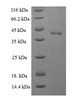 (Tris-Glycine gel) Discontinuous SDS-PAGE (reduced) with 5% enrichment gel and 15% separation gel. (Tris-Glycine gel) Discontinuous SDS-PAGE (reduced) with 5% enrichment gel and 15% separation gel.