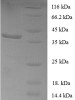 (Tris-Glycine gel) Discontinuous SDS-PAGE (reduced) with 5% enrichment gel and 15% separation gel.