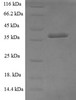 (Tris-Glycine gel) Discontinuous SDS-PAGE (reduced) with 5% enrichment gel and 15% separation gel.