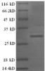 (Tris-Glycine gel) Discontinuous SDS-PAGE (reduced) with 5% enrichment gel and 15% separation gel.