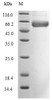 (Tris-Glycine gel) Discontinuous SDS-PAGE (reduced) with 5% enrichment gel and 15% separation gel. Predicted band size: 51.1 kDa
 Observed band size: 66 kDa due to glycosylation