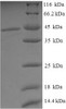 (Tris-Glycine gel) Discontinuous SDS-PAGE (reduced) with 5% enrichment gel and 15% separation gel.