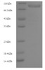 (Tris-Glycine gel) Discontinuous SDS-PAGE (reduced) with 5% enrichment gel and 15% separation gel.