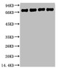Western blot analysis of 1) HepG2, 2) 293T, 3) Mouse Brain Tissue, 4) Rat Brain Tissue, diluted at 1:5000.