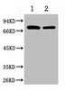 Western blot analysis of 1) Hela, 2) Mouse Brain, diluted at 1:2000.