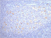 IHC staining of human tonsil tissue, diluted at 1:200.