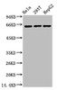 Western blot analysis of 1) Hela, 2) 293T, 3) HepG, diluted at 1:2000.