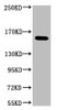 Western blot analysis of 1) Hela, 2) 293, 3) Jurkat, diluted at 1:2000.