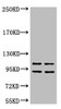 Western blot analysis of 1) Hela, 2) HepG2, diluted at 1:2000