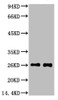 Western blot analysis of 1) Mouse spleen tissue, 2) Rat spleen tissue, diluted at 1:3000.