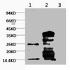 Western blot analysis of Hela, diluted at 1) 1:1000 2) 1:3000