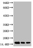 Western blot analysis of 1) Hela, 2) Raw264.7, 3) Rat Brain Tissue, diluted at 1:2000.