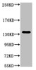 Western blot analysis of Hela, diluted at 1:1000.