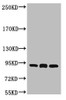 Western blot analysis of 1) Hela, 2) Mouse Brain tissue, 3) Rat Brain tissue, diluted at 1:2000.