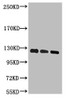 Western blot analysis of 1) Hela, 2) 293T, 3) Jurkat, diluted at 1:2000.
