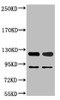 Western blot analysis of 1) Jurkat, 2) Hela, diluted at 1:2000.