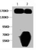 1﹜Input: Hela Cell Lysate 2﹜IP product: IP dilute 1:200 Western blot analysis: primary antibody : 1:1, 000 Secondary antibody: Goat anti-Mouse IgG, Heavy Chain Specific (S003) , 1:5, 000