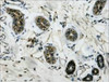 IHC Staining of Human colon tissue, diluted at 1:200.