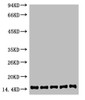 Western blot analysis of 1) Hela, 2) 3T3, 3) Raw264.7, 4) Rat Brain, 5) Rat Kidney, diluted at 1:2000.