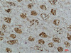 Immunohistochemical analysis of paraffin-embedded Human Kidney Tissue using IκB βMouse mAb diluted at 1:200.