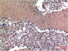 Immunohistochemical analysis of paraffin-embedded Human lung Tissue using Cyclin B1 Mouse mAb diluted at 1:200.