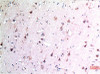 Immunohistochemical analysis of paraffin-embedded Human Brain Tissue using Beclin-1 Mouse mAb diluted at 1:200.