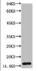 Western blot analysis of Human Serum using TTR Mouse mAb diluted at 1:2000