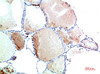 Immunohistochemical analysis of paraffin-embedded Human Thyroid Tissue using TTR Mouse mAb diluted at 1:200.