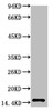 Western blot analysis of Human Serum using TTR Mouse mAb diluted at 1:2000