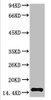 Western blot analysis of Human Serum using TTR Mouse mAb diluted at 1:2000