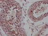 IHC image of CSB-MA999605 diluted at 1:100 and staining in paraffin-embedded human testis tissue performed on a Leica BondTM system. After dewaxing and hydration, antigen retrieval was mediated by high pressure in a citrate buffer (pH 6.0) . Section was blocked with 10% normal goat serum 30min at RT. Then primary antibody (1% BSA) was incubated at 4°C overnight. The primary is detected by a Goat anti-mouse IgG polymer labeled by HRP and visualized using 0.05% DAB.