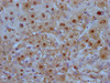 IHC image of CSB-MA908650 diluted at 1:100 and staining in paraffin-embedded human liver tissue performed on a Leica BondTM system. After dewaxing and hydration, antigen retrieval was mediated by high pressure in a citrate buffer (pH 6.0) . Section was blocked with 10% normal goat serum 30min at RT. Then primary antibody (1% BSA) was incubated at 4°C overnight. The primary is detected by a Goat anti-mouse IgG polymer labeled by HRP and visualized using 0.05% DAB.