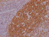 IHC image of CSB-MA181399 diluted at 1:100 and staining in paraffin-embedded human lymph node tissue performed on a Leica BondTM system. After dewaxing and hydration, antigen retrieval was mediated by high pressure in a citrate buffer (pH 6.0) . Section was blocked with 10% normal goat serum 30min at RT. Then primary antibody (1% BSA) was incubated at 4°C overnight. The primary is detected by a Goat anti-mouse IgG polymer labeled by HRP and visualized using 0.05% DAB.