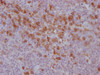 IHC image of CSB-MA785760 diluted at 1:100 and staining in paraffin-embedded human tonsil tissue performed on a Leica BondTM system. After dewaxing and hydration, antigen retrieval was mediated by high pressure in a citrate buffer (pH 6.0) . Section was blocked with 10% normal goat serum 30min at RT. Then primary antibody (1% BSA) was incubated at 4°C overnight. The primary is detected by a Goat anti-mouse IgG polymer labeled by HRP and visualized using 0.05% DAB.