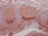 IHC image of CSB-MA961575 diluted at 1:100 and staining in paraffin-embedded human tonsil tissue performed on a Leica BondTM system. After dewaxing and hydration, antigen retrieval was mediated by high pressure in a citrate buffer (pH 6.0) . Section was blocked with 10% normal goat serum 30min at RT. Then primary antibody (1% BSA) was incubated at 4°C overnight. The primary is detected by a Goat anti-mouse IgG polymer labeled by HRP and visualized using 0.05% DAB.