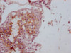 IHC image of CSB-MA153712 diluted at 1:100 and staining in paraffin-embedded human testis tissue performed on a Leica BondTM system. After dewaxing and hydration, antigen retrieval was mediated by high pressure in a citrate buffer (pH 6.0) . Section was blocked with 10% normal goat serum 30min at RT. Then primary antibody (1% BSA) was incubated at 4°C overnight. The primary is detected by a Goat anti-mouse IgG polymer labeled by HRP and visualized using 0.05% DAB.