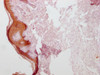 IHC image of CSB-MA555839 diluted at 1:100 and staining in paraffin-embedded human skin tissue performed on a Leica BondTM system. After dewaxing and hydration, antigen retrieval was mediated by high pressure in a citrate buffer (pH 6.0) . Section was blocked with 10% normal goat serum 30min at RT. Then primary antibody (1% BSA) was incubated at 4°C overnight. The primary is detected by a Goat anti-mouse IgG polymer labeled by HRP and visualized using 0.05% DAB.