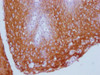 IHC image of CSB-MA299720 diluted at 1:100 and staining in paraffin-embedded human tonsil tissue performed on a Leica BondTM system. After dewaxing and hydration, antigen retrieval was mediated by high pressure in a citrate buffer (pH 6.0) . Section was blocked with 10% normal goat serum 30min at RT. Then primary antibody (1% BSA) was incubated at 4°C overnight. The primary is detected by a Goat anti-mouse IgG polymer labeled by HRP and visualized using 0.05% DAB.