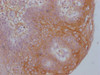 IHC image of CSB-MA192596 diluted at 1:100 and staining in paraffin-embedded human tonsil tissue performed on a Leica BondTM system. After dewaxing and hydration, antigen retrieval was mediated by high pressure in a citrate buffer (pH 6.0) . Section was blocked with 10% normal goat serum 30min at RT. Then primary antibody (1% BSA) was incubated at 4°C overnight. The primary is detected by a Goat anti-mouse IgG polymer labeled by HRP and visualized using 0.05% DAB.