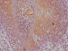 IHC image of CSB-MA898464 diluted at 1:100 and staining in paraffin-embedded human tonsil tissue performed on a Leica BondTM system. After dewaxing and hydration, antigen retrieval was mediated by high pressure in a citrate buffer (pH 6.0) . Section was blocked with 10% normal goat serum 30min at RT. Then primary antibody (1% BSA) was incubated at 4°C overnight. The primary is detected by a Goat anti-mouse IgG polymer labeled by HRP and visualized using 0.05% DAB.