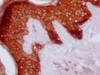 IHC image of CSB-MA789445 diluted at 1:100 and staining in paraffin-embedded human skin tissue performed on a Leica BondTM system. After dewaxing and hydration, antigen retrieval was mediated by high pressure in a citrate buffer (pH 6.0) . Section was blocked with 10% normal goat serum 30min at RT. Then primary antibody (1% BSA) was incubated at 4°C overnight. The primary is detected by a Goat anti-mouse IgG polymer labeled by HRP and visualized using 0.05% DAB.