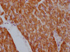 IHC image of CSB-MA923561 diluted at 1:100 and staining in paraffin-embedded human heart tissue performed on a Leica BondTM system. After dewaxing and hydration, antigen retrieval was mediated by high pressure in a citrate buffer (pH 6.0) . Section was blocked with 10% normal goat serum 30min at RT. Then primary antibody (1% BSA) was incubated at 4°C overnight. The primary is detected by a Goat anti-mouse IgG polymer labeled by HRP and visualized using 0.05% DAB.